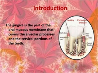 Introduction
The gingiva is the part of the
oral mucous membrane that
covers the alveolar processes
and the cervical portions of
the teeth.
 