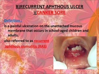 B)RECURRENT APHTHOUS ULCER
(CANKER SORE(
Definition :
is a painful ulceration on the unattached mucous
membrane that occurs in school-aged children and
adults.
also referred to as recurrent
aphthous stomatitis (RAS)
 
