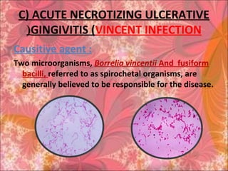 C) ACUTE NECROTIZING ULCERATIVE
GINGIVITIS (VINCENT INFECTION(
Causitive agent :
Two microorganisms, Borrelia vincentii And fusiform
bacilli, referred to as spirochetal organisms, are
generally believed to be responsible for the disease.
 