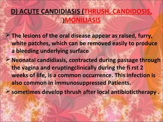 D) ACUTE CANDIDIASIS (THRUSH, CANDIDOSIS,
MONILIASIS(
 The lesions of the oral disease appear as raised, furry,
white patches, which can be removed easily to produce
a bleeding underlying surface
 Neonatal candidiasis, contracted during passage through
the vagina and eruptingclinically during the fi rst 2
weeks of life, is a common occurrence. This infection is
also common in immunosuppressed Patients.
 sometimes develop thrush after local antibiotictherapy .
 