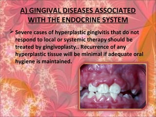 A) GINGIVAL DISEASES ASSOCIATED
WITH THE ENDOCRINE SYSTEM
 Severe cases of hyperplastic gingivitis that do not
respond to local or systemic therapy should be
treated by gingivoplasty.. Recurrence of any
hyperplastic tissue will be minimal if adequate oral
hygiene is maintained.
 