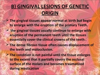 B) GINGIVAL LESIONS OF GENETIC
ORIGIN
 The gingival tissues appear normal at birth but begin
to enlarge with the eruption of the primary Teeth.
 the gingival tissues usually continue to enlarge with
eruption of the permanent teeth until the tissues
essentially cover the clinical crowns of the teeth .
 The dense fibrous tissue often causes displacement of
the teeth and malocclusion.
 The condition is not painful until the tissue enlarges
to the extent that it partially covers the occlusal
surface of the molars and becomes traumatized
during mastication
 