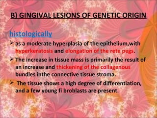 B) GINGIVAL LESIONS OF GENETIC ORIGIN
histologically
 as a moderate hyperplasia of the epithelium,with
hyperkeratosis and elongation of the rete pegs.
 The increase in tissue mass is primarily the result of
an increase and thickening of the collagenous
bundles inthe connective tissue stroma.
 The tissue shows a high degree of differentiation,
and a few young fi broblasts are present.
 