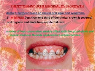 PHENYTOIN-INDUCED GINGIVAL OVERGROWTH
dental treatment based on clinical oral signs and symptoms.
1) mild PIGO (less than one third of the clinical crown is covered)
oral hygiene and more frequent dental care.
a series of four consecutive weekly office visits for prophylaxis and
topical stannous fluoride application is recommended.
 