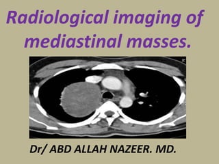 Radiological imaging of
mediastinal masses.
Dr/ ABD ALLAH NAZEER. MD.
 