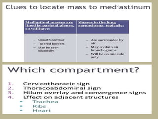 Mediastinal Algorithm Presentation1.pptx radiological imaging of mediastinal masses . | PPTX