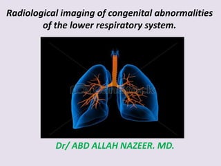 Radiological imaging of congenital abnormalities
of the lower respiratory system.
Dr/ ABD ALLAH NAZEER. MD.
 