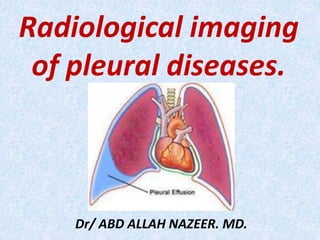 Radiological imaging
of pleural diseases.
Dr/ ABD ALLAH NAZEER. MD.
 