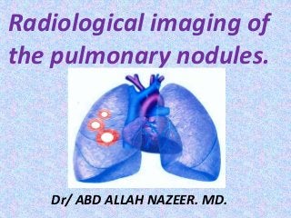 Radiological imaging of
the pulmonary nodules.
Dr/ ABD ALLAH NAZEER. MD.
 
