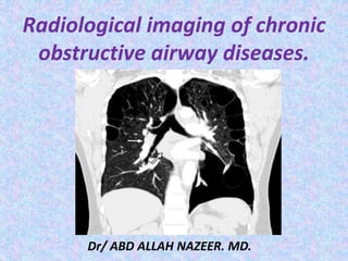 Radiological imaging of chronic
obstructive airway diseases.
Dr/ ABD ALLAH NAZEER. MD.
 