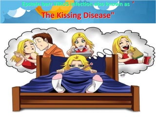 Epstein barr VIRUS infection also known as ‘
The Kissing Disease"
9
 