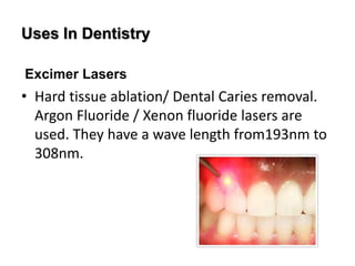Uses In Dentistry
Excimer Lasers
• Hard tissue ablation/ Dental Caries removal.
Argon Fluoride / Xenon fluoride lasers are
used. They have a wave length from193nm to
308nm.
 