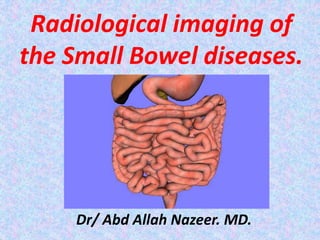 Radiological imaging of
the Small Bowel diseases.
Dr/ Abd Allah Nazeer. MD.
 
