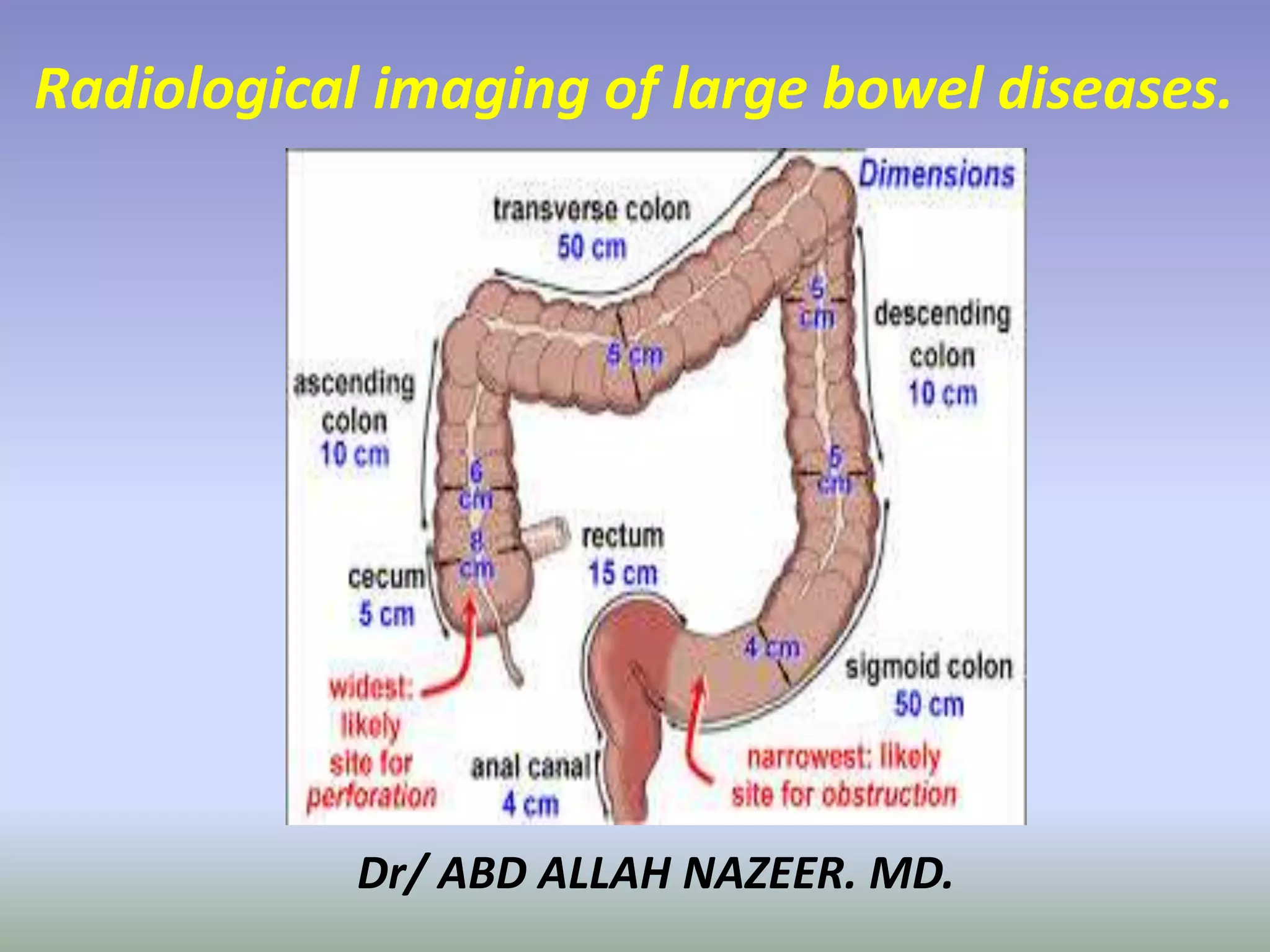 Presentation1.pptx, radiological imaging of large bowel diseases | PPTX