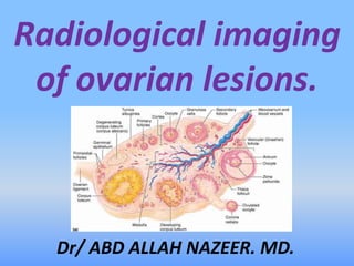 Radiological imaging
of ovarian lesions.
Dr/ ABD ALLAH NAZEER. MD.
 