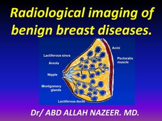 Radiological imaging of
benign breast diseases.
Dr/ ABD ALLAH NAZEER. MD.
 