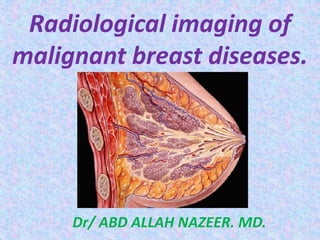 Radiological imaging of
malignant breast diseases.
Dr/ ABD ALLAH NAZEER. MD.
 