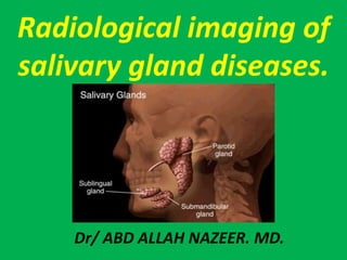 Radiological imaging of
salivary gland diseases.
Dr/ ABD ALLAH NAZEER. MD.
 