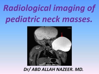 Radiological imaging of
pediatric neck masses.
Dr/ ABD ALLAH NAZEER. MD.
 