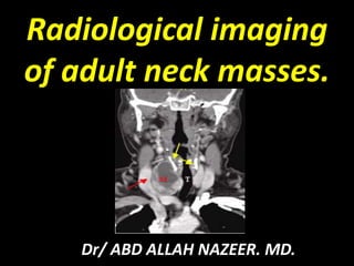 Radiological imaging
of adult neck masses.
Dr/ ABD ALLAH NAZEER. MD.
 