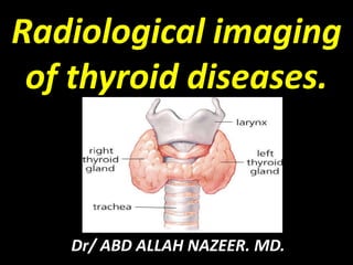 Radiological imaging
of thyroid diseases.
Dr/ ABD ALLAH NAZEER. MD.
 