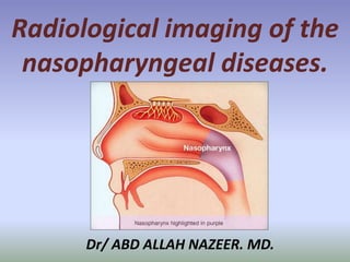 Dr/ ABD ALLAH NAZEER. MD.
Radiological imaging of the
nasopharyngeal diseases.
 