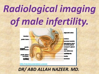 Radiological imaging
of male infertility.
DR/ ABD ALLAH NAZEER. MD.
 