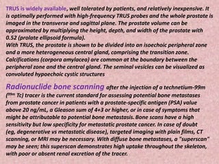 TRUS is widely available, well tolerated by patients, and relatively inexpensive. It
is optimally performed with high-frequency TRUS probes and the whole prostate is
imaged in the transverse and sagittal plane. The prostate volume can be
approximated by multiplying the height, depth, and width of the prostate with
0.52 (prolate ellipsoid formula).
With TRUS, the prostate is shown to be divided into an isoechoic peripheral zone
and a more heterogeneous central gland, comprising the transition zone.
Calcifications (corpora amylacea) are common at the boundary between the
peripheral zone and the central gland. The seminal vesicles can be visualized as
convoluted hypoechoic cystic structures
Radionuclide bone scanning after the injection of a technetium-99m
(99m Tc) tracer is the current standard for assessing potential bone metastases
from prostate cancer in patients with a prostate-specific antigen (PSA) value
above 20 ng/mL, a Gleason sum of 4+3 or higher, or in case of symptoms that
might be attributable to potential bone metastasis.Bone scans have a high
sensitivity but low specificity for metastatic prostate cancer. In case of doubt
(eg, degenerative vs metastatic disease), targeted imaging with plain films, CT
scanning, or MRI may be necessary. With diffuse bone metastases, a "superscan"
may be seen; this superscan demonstrates high uptake throughout the skeleton,
with poor or absent renal excretion of the tracer.
 