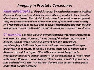 Imaging in Prostate Carcinoma:
Plain radiographs of the pelvis cannot be used to demonstrate localized
disease in the prostate, and they are generally only needed in the evaluation
of metastatic disease. Most skeletal metastases from prostate cancer (about
85%) are osteoblastic and are visible as an area of abnormal tracer activity
on a radionuclide bone scan. In case of doubt, targeted imaging with skeletal
radiographs can help distinguish metastatic areas from degenerative disease.
CT scanning has little value in demonstrating intraprostatic pathology
and in local staging. However, it may be helpful in detecting metastatic
disease, such as lymph node involvement or bone metastases.
Nodal staging is indicated in patients with a prostate-specific antigen
(PSA) value of 20 ng/mL or higher, a clinical stage T2b or higher, and a
Gleason score of 7 or higher. CT or MRI scans depict lymph node
enlargement and have similar accuracy for the evaluation of lymph node
metastases. However, nodal staging relies on assessment of lymph node
size, and neither CT scan nor MRI can demonstrate cancer within lymph
nodes that are not enlarged.
 