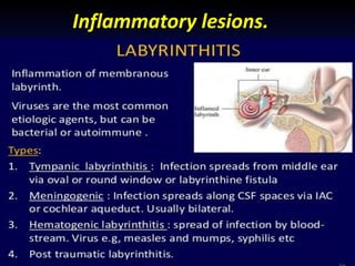 Presentation1.pptx, radiological imaging of inner ear diseases | PPTX