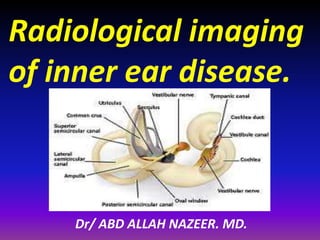 Radiological imaging
of inner ear disease.
Dr/ ABD ALLAH NAZEER. MD.
 
