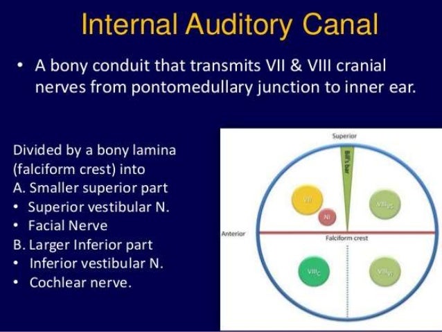 Presentation1 Pptx Radiological Imaging Of Inner Ear Diseases