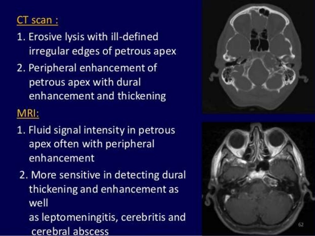 Presentation1.pptx, radiological imaging of inner ear diseases