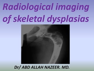 Radiological imaging 
of skeletal dysplasias 
Dr/ ABD ALLAH NAZEER. MD. 
 
