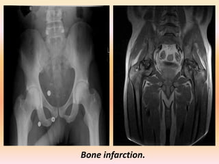 Presentation1.pptx, lecture for md oral examination. | PPTX