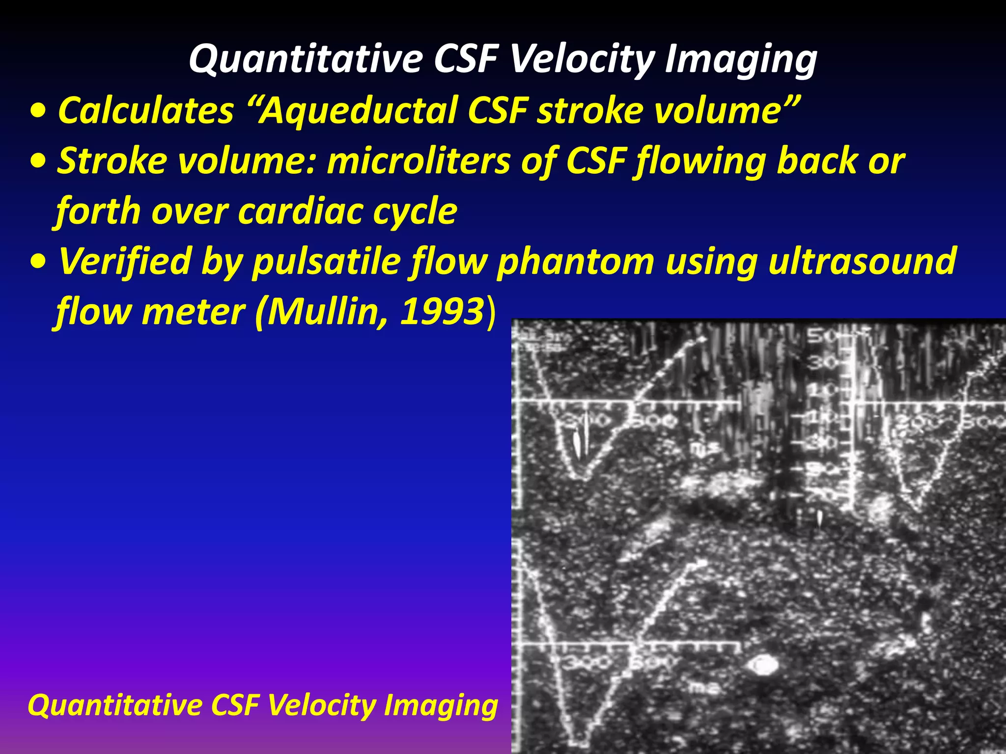 Quantitative CSF Velocity Imaging 
• Calculates “Aqueductal CSF stroke volume” 
• Stroke volume: microliters of CSF flowing back or 
forth over cardiac cycle 
• Verified by pulsatile flow phantom using ultrasound 
flow meter (Mullin, 1993) 
Quantitative CSF Velocity Imaging 
 