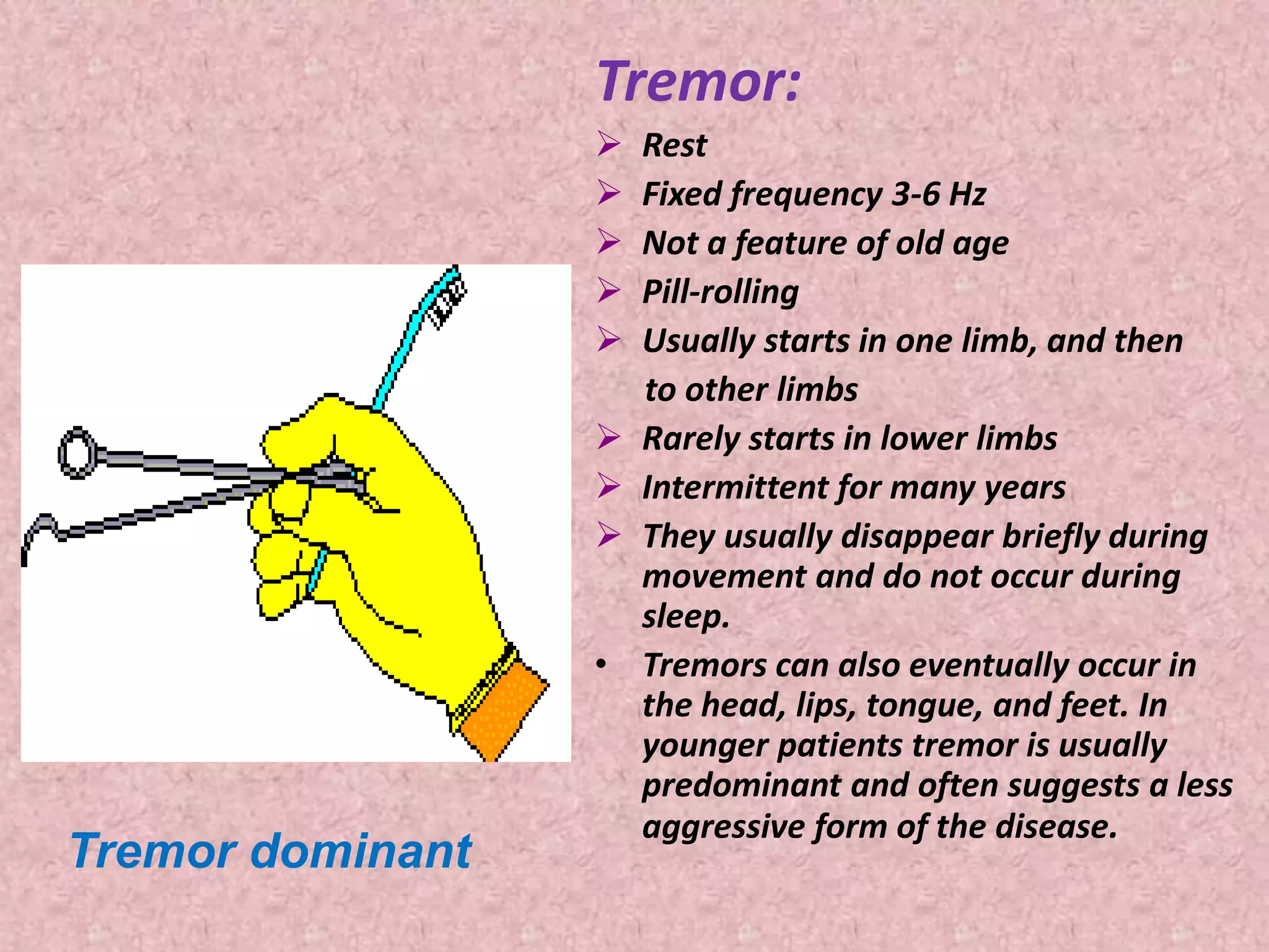 Tremor dominant 
Tremor: 
 Rest 
 Fixed frequency 3-6 Hz 
 Not a feature of old age 
 Pill-rolling 
 Usually starts in one limb, and then 
to other limbs 
 Rarely starts in lower limbs 
 Intermittent for many years 
 They usually disappear briefly during 
movement and do not occur during 
sleep. 
• Tremors can also eventually occur in 
the head, lips, tongue, and feet. In 
younger patients tremor is usually 
predominant and often suggests a less 
aggressive form of the disease. 
 