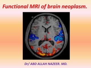 Functional MRI of brain neoplasm. 
Dr/ ABD ALLAH NAZEER. MD. 
 