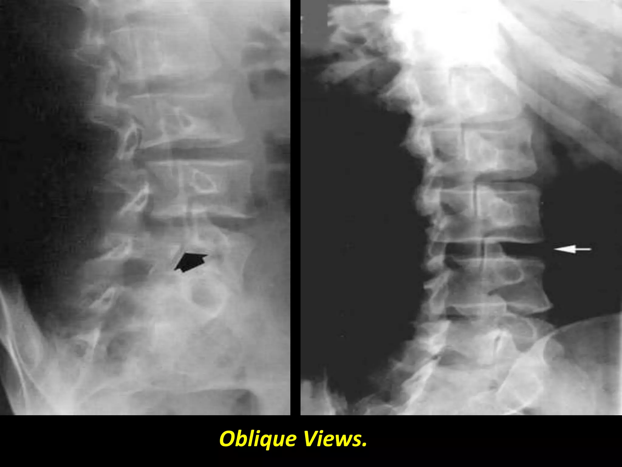 Oblique Views. 
 