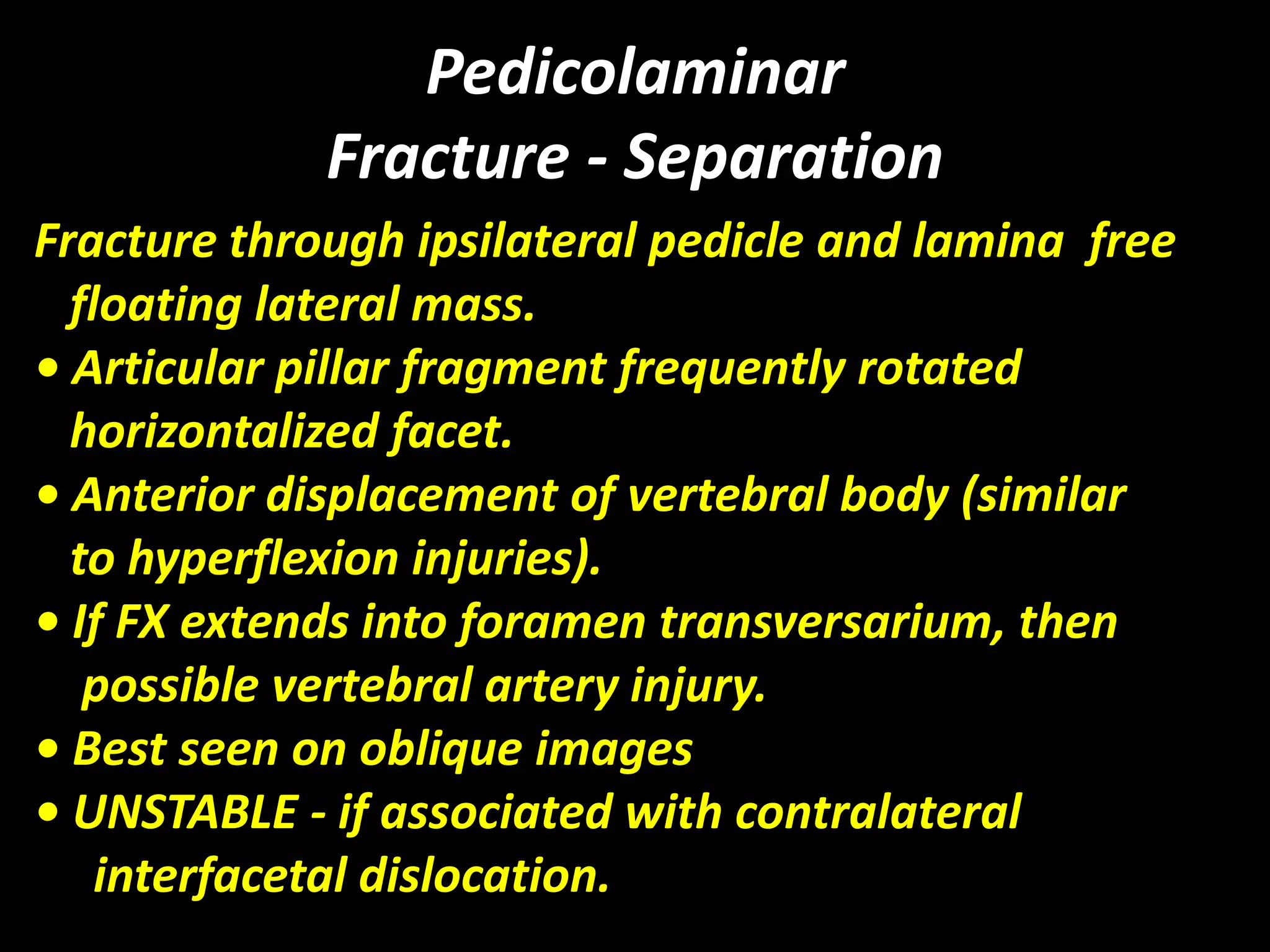 Pedicolaminar 
Fracture - Separation 
Fracture through ipsilateral pedicle and lamina free 
floating lateral mass. 
• Articular pillar fragment frequently rotated 
horizontalized facet. 
• Anterior displacement of vertebral body (similar 
to hyperflexion injuries). 
• If FX extends into foramen transversarium, then 
possible vertebral artery injury. 
• Best seen on oblique images 
• UNSTABLE - if associated with contralateral 
interfacetal dislocation. 
 