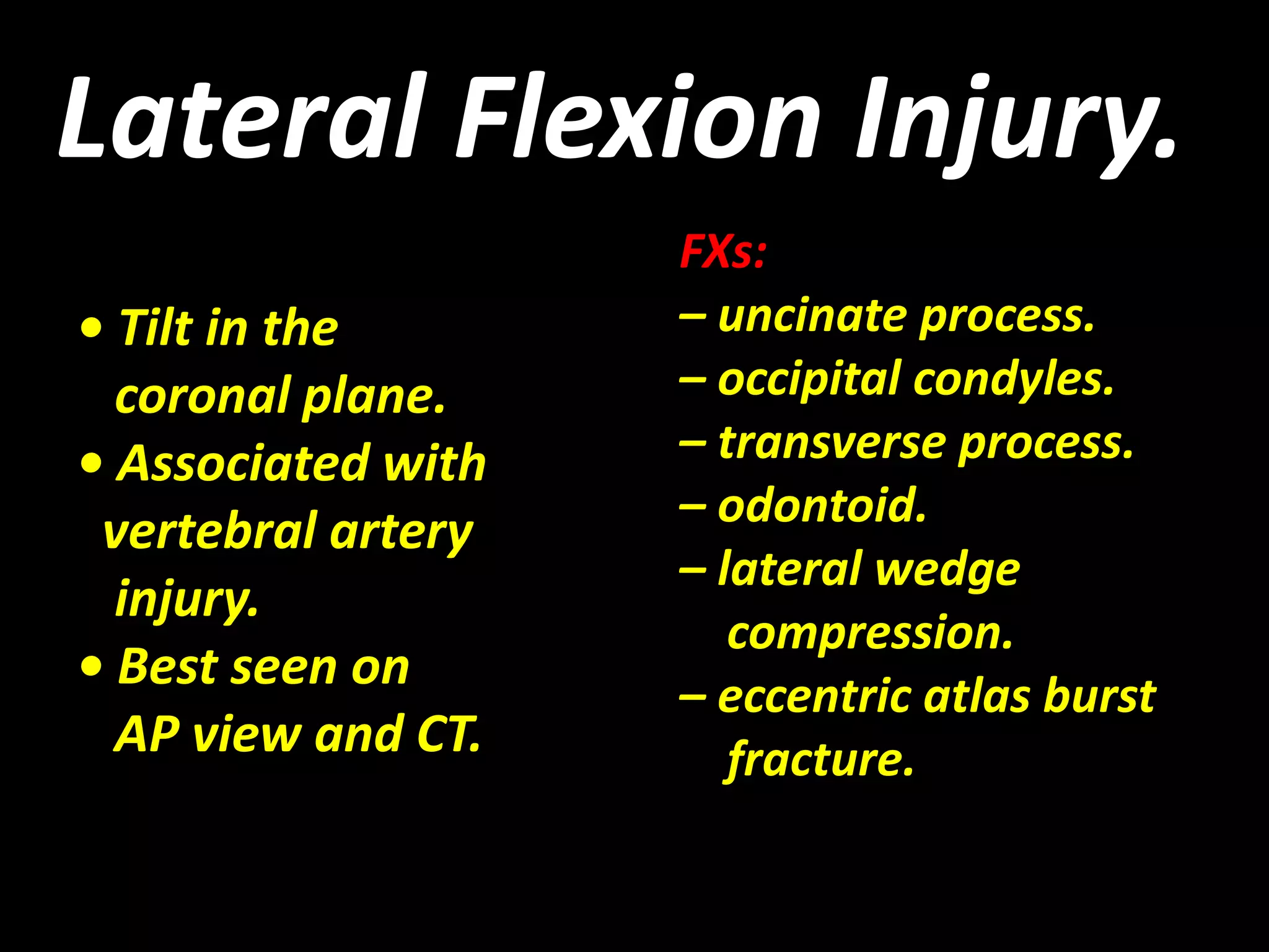 Lateral Flexion Injury. 
• Tilt in the 
coronal plane. 
• Associated with 
vertebral artery 
injury. 
• Best seen on 
AP view and CT. 
FXs: 
– uncinate process. 
– occipital condyles. 
– transverse process. 
– odontoid. 
– lateral wedge 
compression. 
– eccentric atlas burst 
fracture. 
 