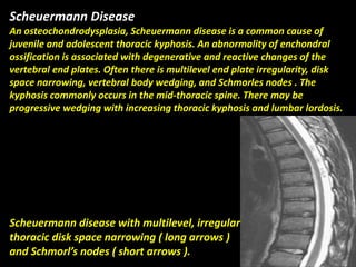 Presentation1.pptx, radiological imaging of congenital anomalies of the ...