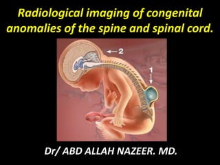 Radiological imaging of congenital 
anomalies of the spine and spinal cord. 
Dr/ ABD ALLAH NAZEER. MD. 
 