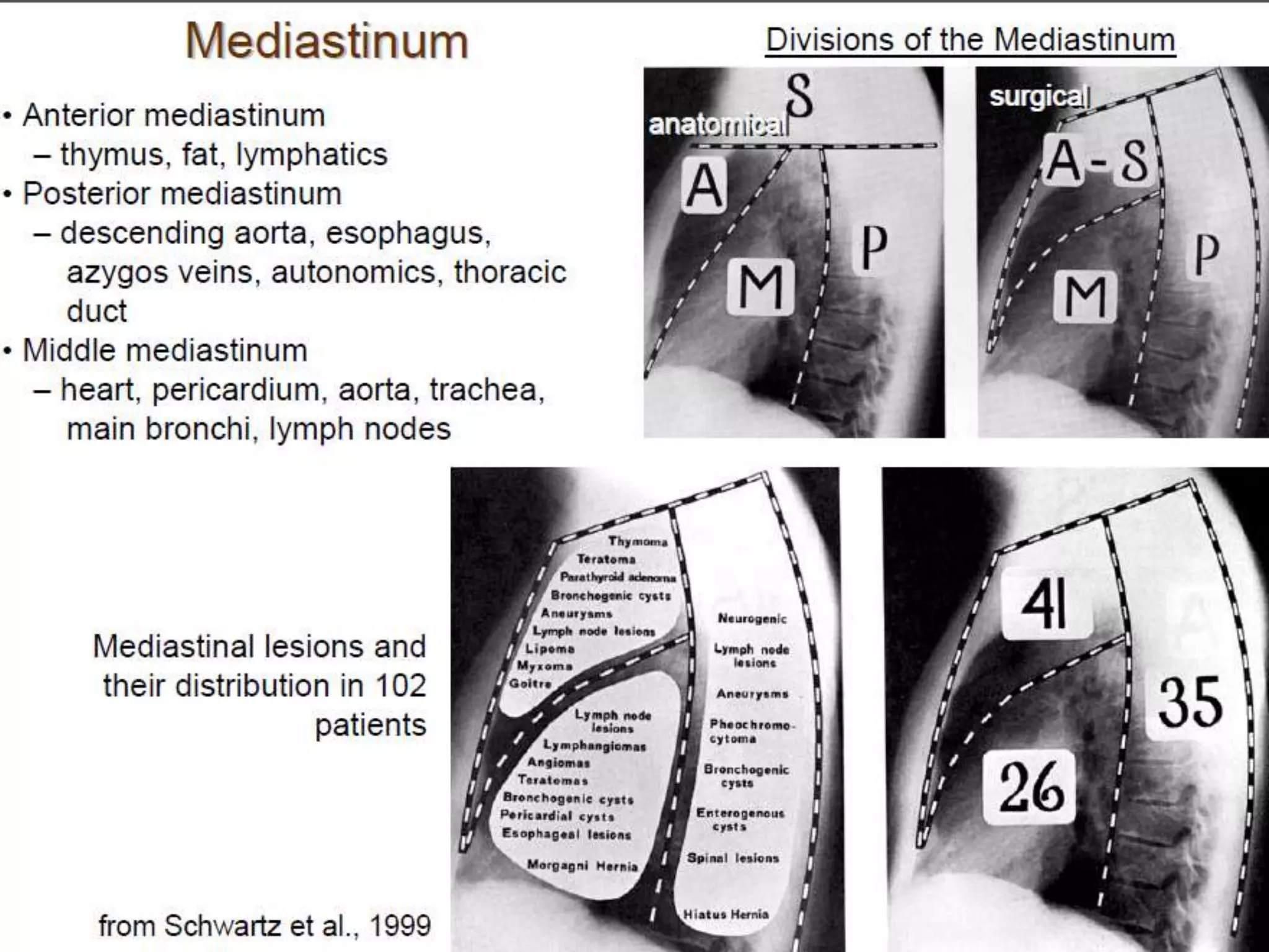 Chest Level Presentation1.pptx, radiological anatomy of the chest. | PPTX