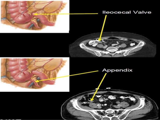 Presentation1.pptx, radiological anatomy of the abdomen and pelvis.