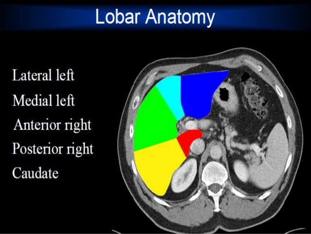 Presentation1.pptx, radiological anatomy of the abdomen and pelvis.