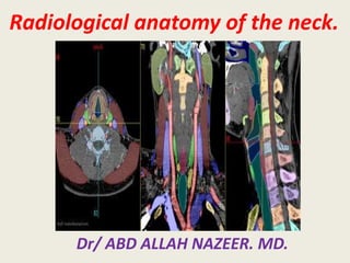 Radiological anatomy of the neck. 
Dr/ ABD ALLAH NAZEER. MD. 
 