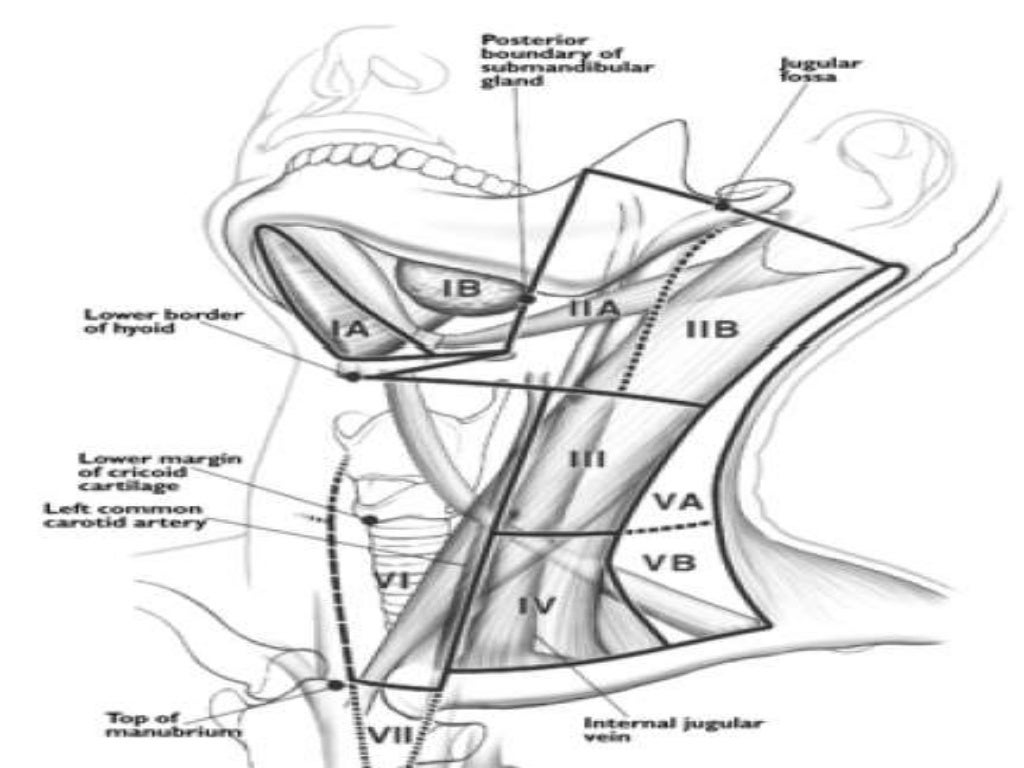 Presentation1.pptx, radiological anatomy of the neck.