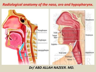 Radiological anatomy of the naso, oro and hypopharynx. 
Dr/ ABD ALLAH NAZEER. MD. 
 