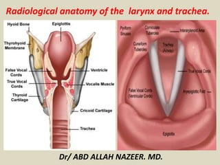 Radiological anatomy of the larynx and trachea. 
Dr/ ABD ALLAH NAZEER. MD. 
 